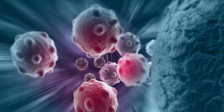 ЩО НЕОБХІДНО ЗНАТИ ПРО РАК?