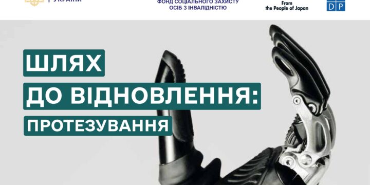 Шлях до відновлення: протезування осіб з ампутацією