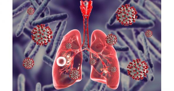 Туберкульоз — інфекційне захворювання, спричинене мікобактеріями туберкульозу